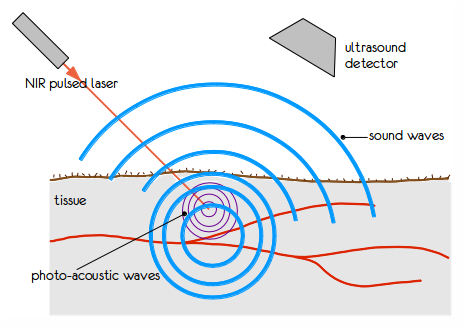 Illustration of photoacoustic tomography